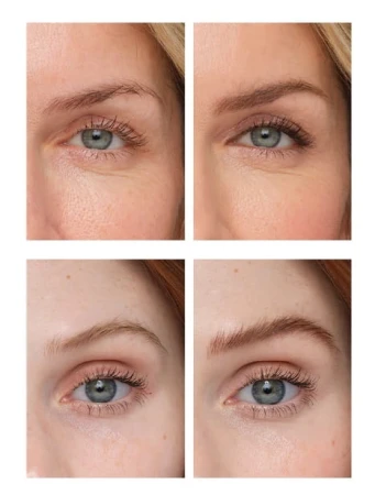 Zbliżenie na brwi dwóch modelek przed i po użyciu PureBrow Brow Gel. Widać pogłębienie koloru, lepszą symetrię brwi i wyraźniejsze rysy twarzy.