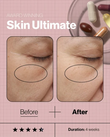Reklama suplementu „Skin Ultimate” pokazuje skórę przed i po 4 tygodniach stosowania – zmniejszenie zmarszczek i wygładzenie. Widać kapsułki, nazwę produktu, ocenę 4,5 gwiazdki i informację: „Duration: 4 weeks”.